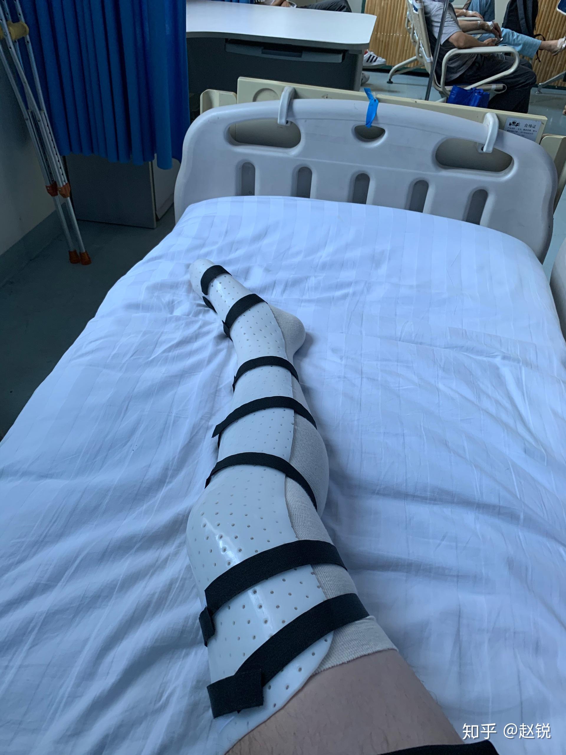 跟腱断裂2020.6 - 知乎