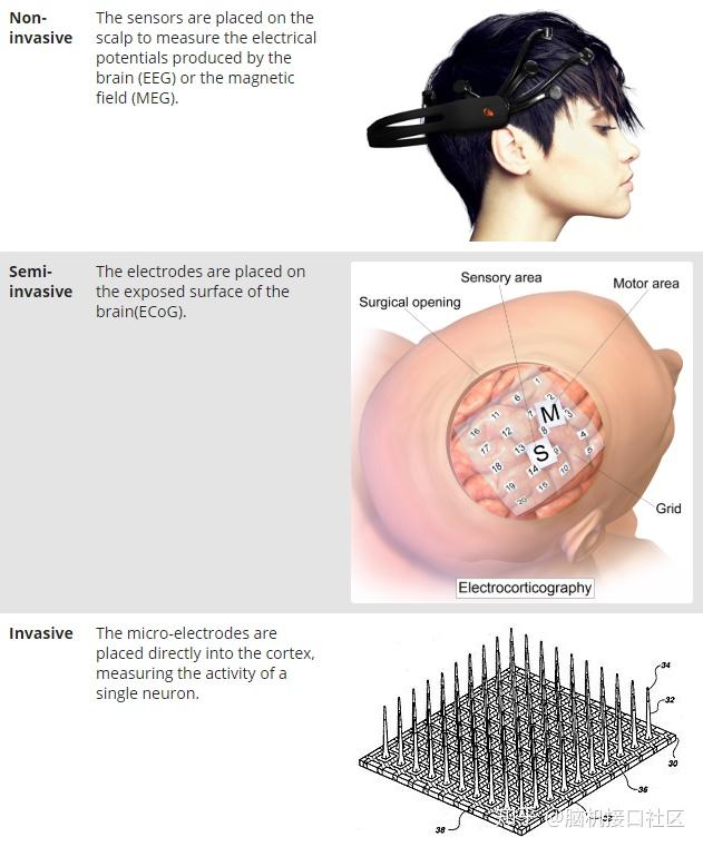半侵入式:ecog信号取自硬脑膜或蛛网膜上的电极