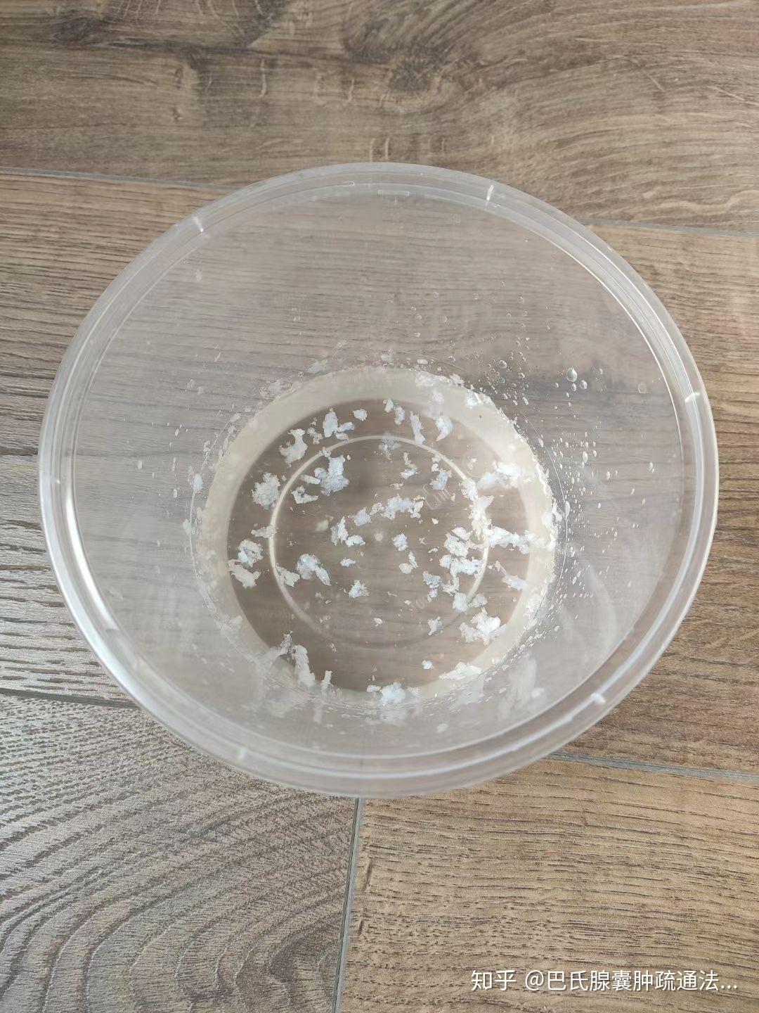 这样的巴氏腺囊肿黏液,你见过吗? - 知乎