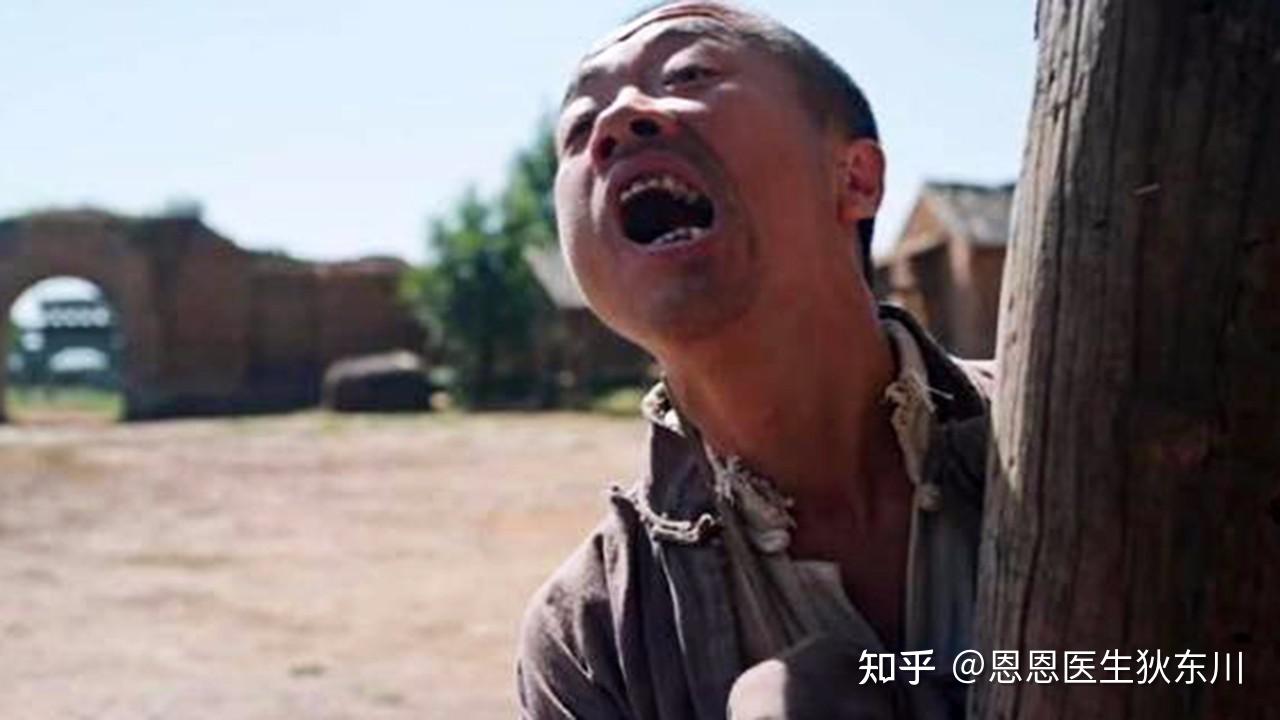 精神分裂症疯子这些症状常人也会有