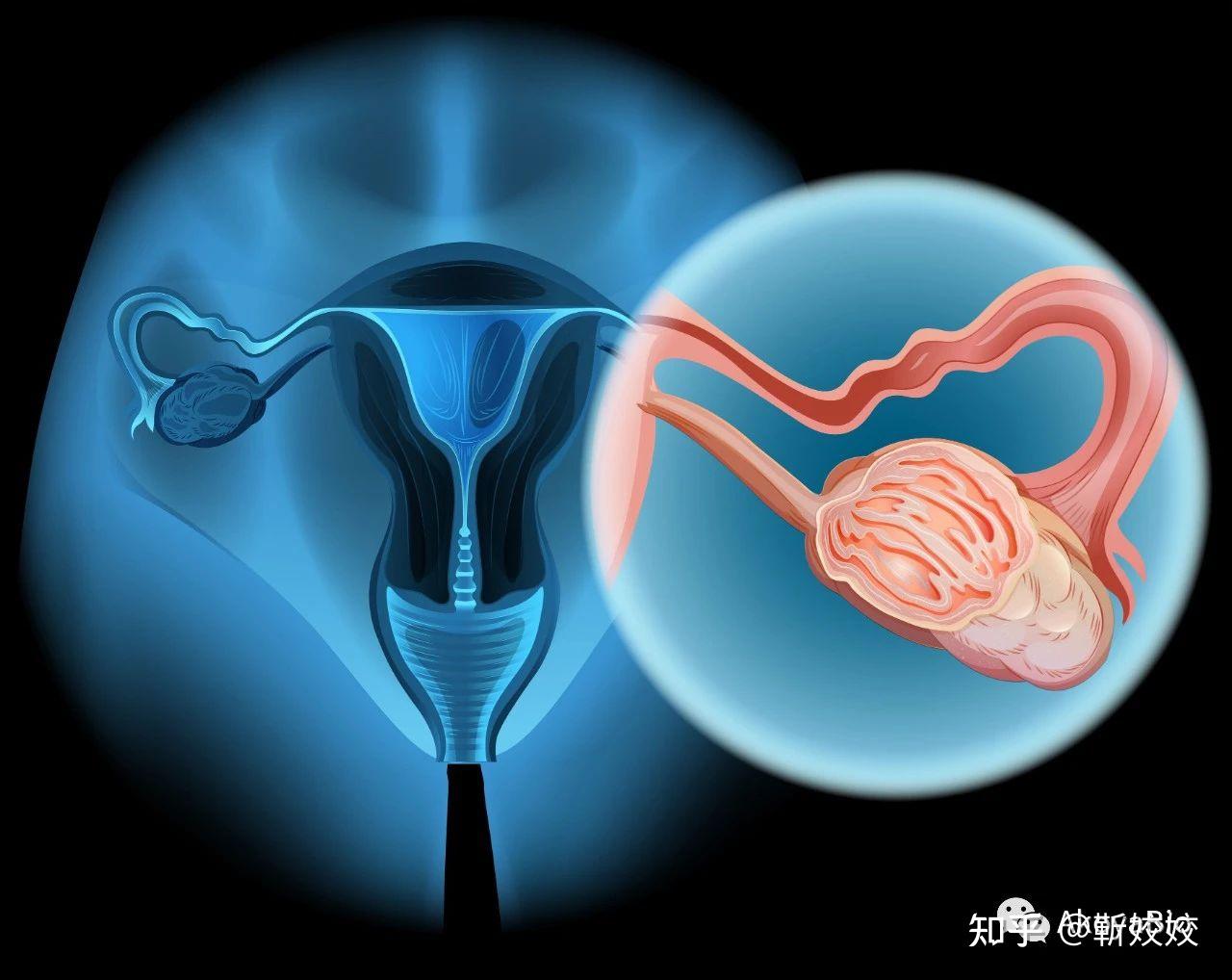 女性生殖系统解剖学各器官位置示意图子宫、子宫颈、卵巢、输卵管。妇女的健康。矢量插图。插画图片素材_ID:422300788-Veer图库