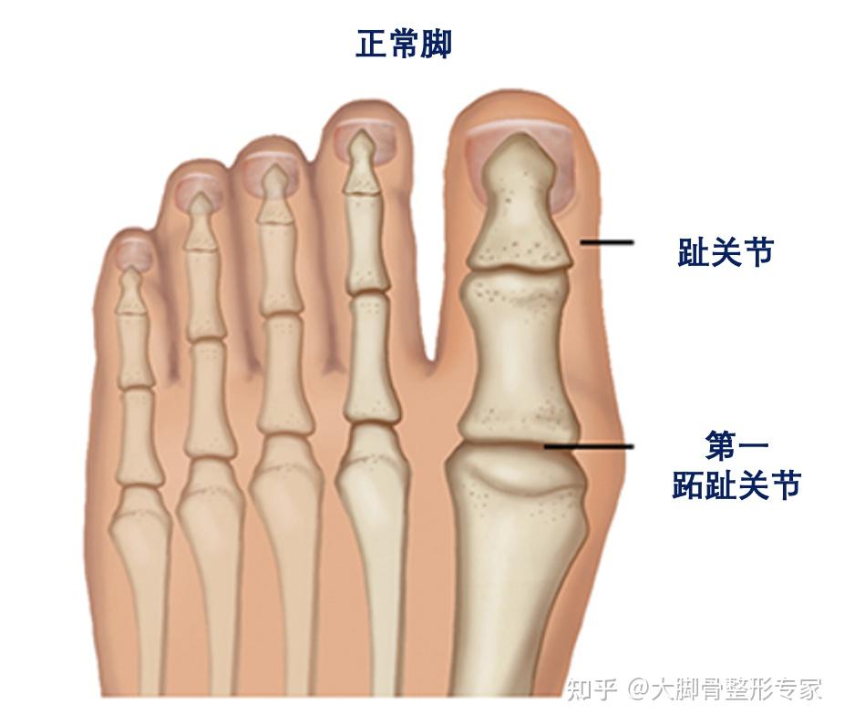 正常脚内部结构正常脚各跖趾关节对合整齐