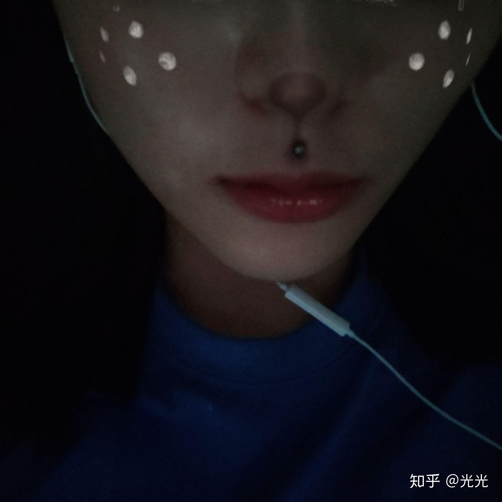 伟德国际舌钉多久可以下掉会不会愈合