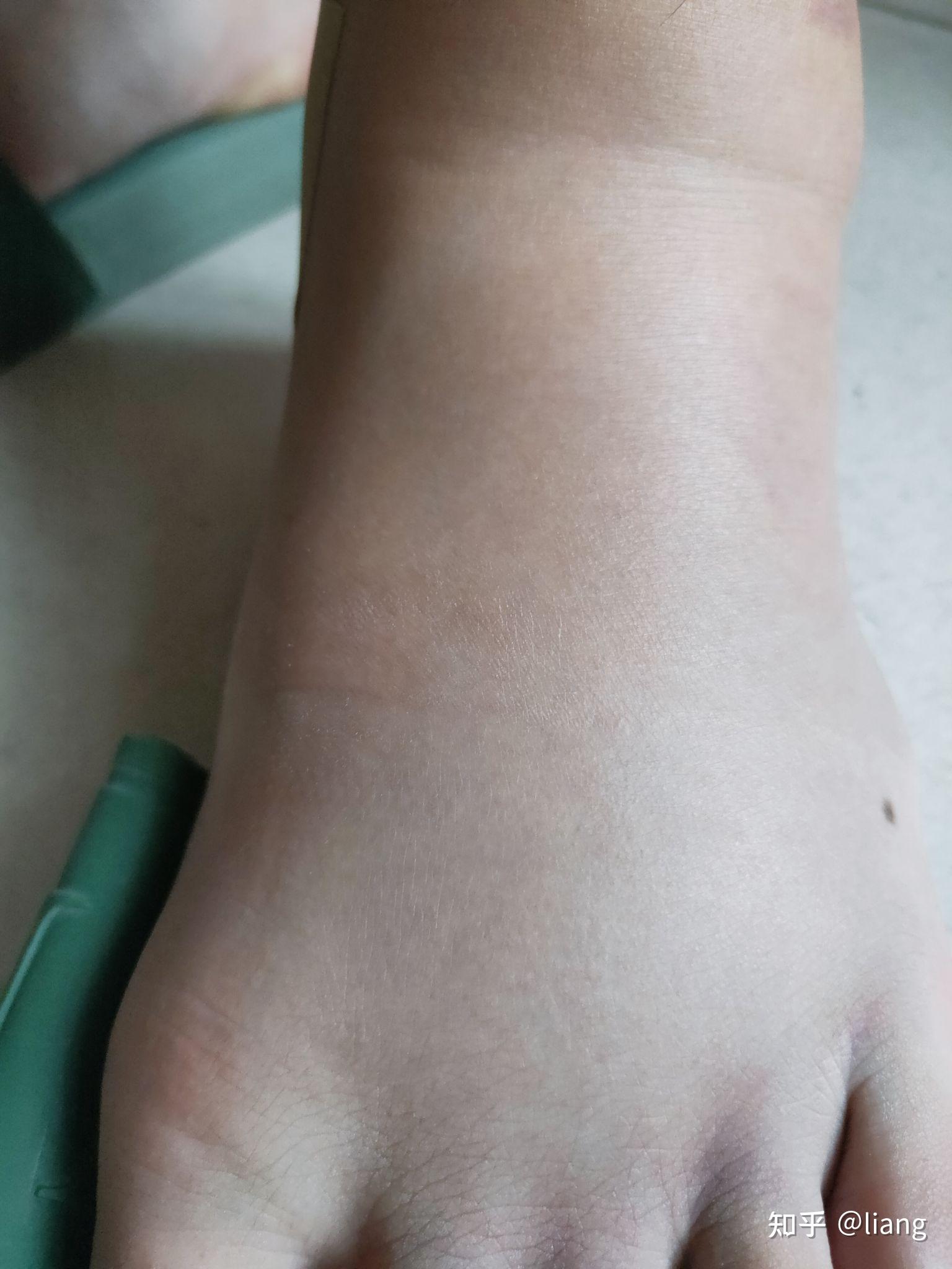 打篮球被垫脚了