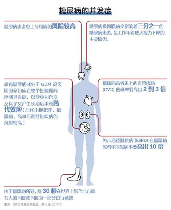 关于糖尿病 我们应该知道些什么 知乎