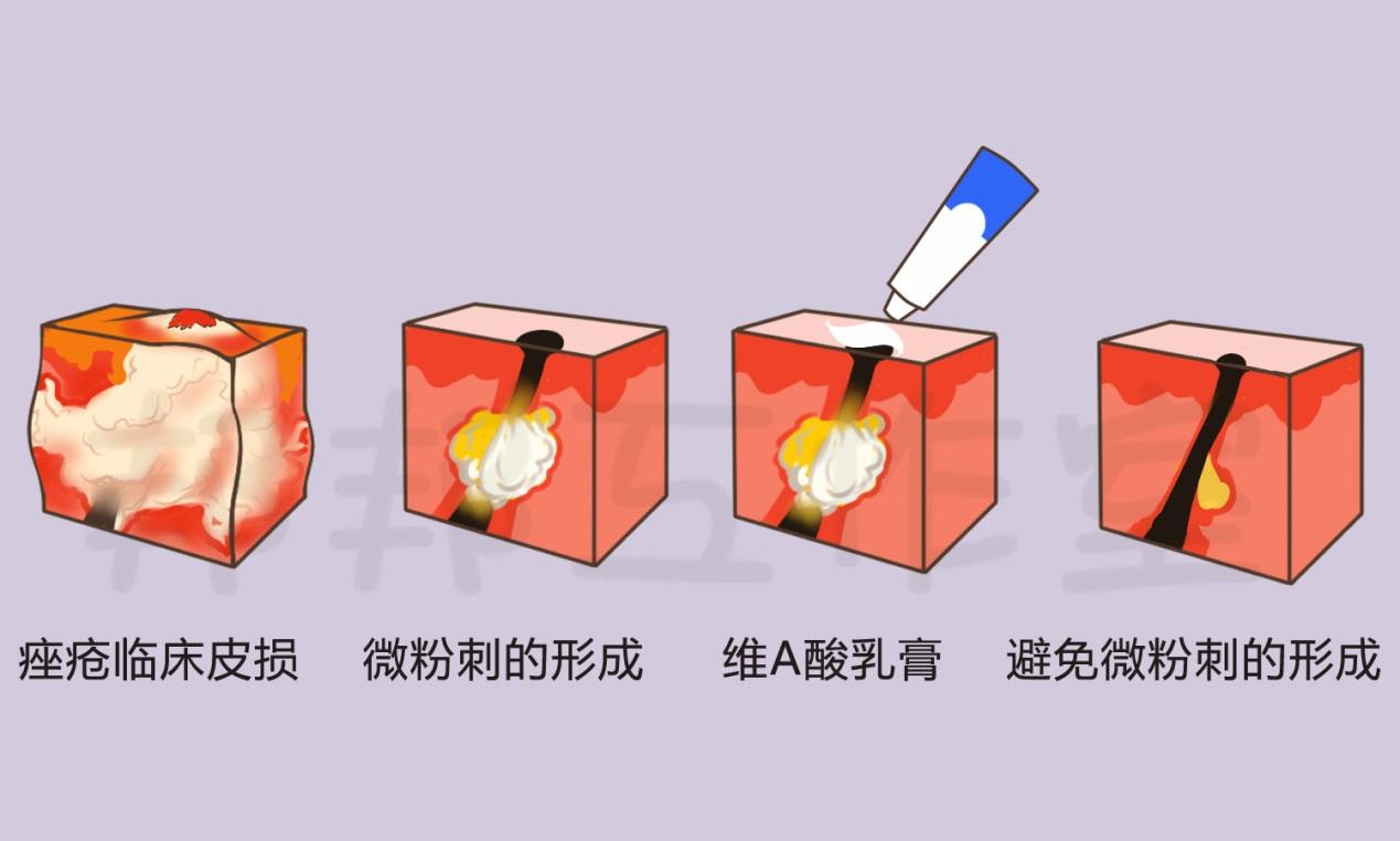 v2-30be8dc44dab8e7f93d29399f0ec93e7_r.jpg