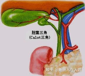 15. 胆系疾病 - 知乎