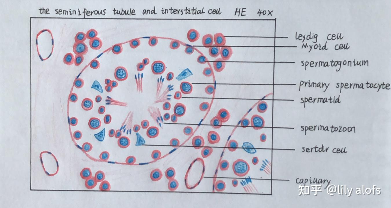 朗格汉斯巨细胞手绘图图片
