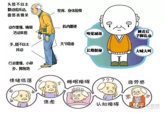 3.除手抖外,帕金森病还有什么症状?