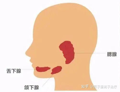 如何有效缓解放疗引发的口干 - 知乎