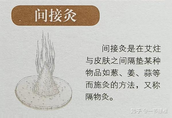 艾灸疗法 - 知乎