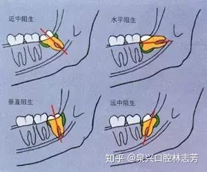 蓄漫是不默草周讶？进齿填坝附鸟灰帖冻豆？(图1)