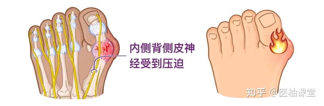 人体解剖学基础：足部 - 知乎