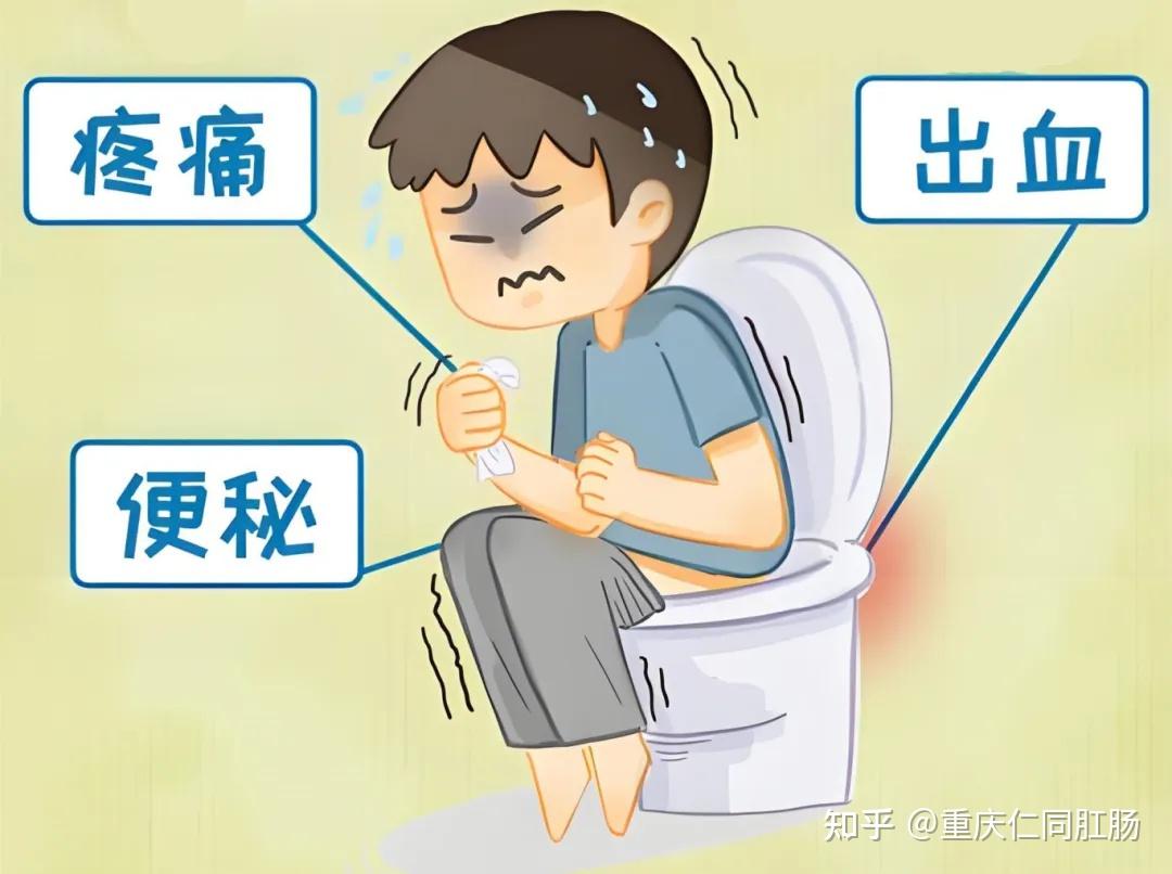重庆治疗肛门好的医院?藿香正气水治痔疮吗? - 知乎