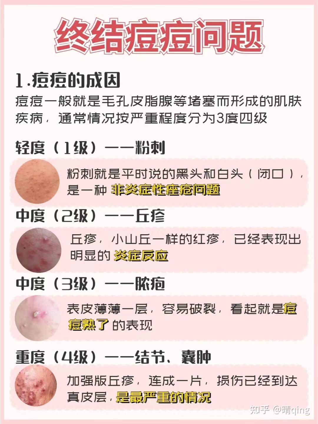 如何快速祛痘变美！！！ - 知乎