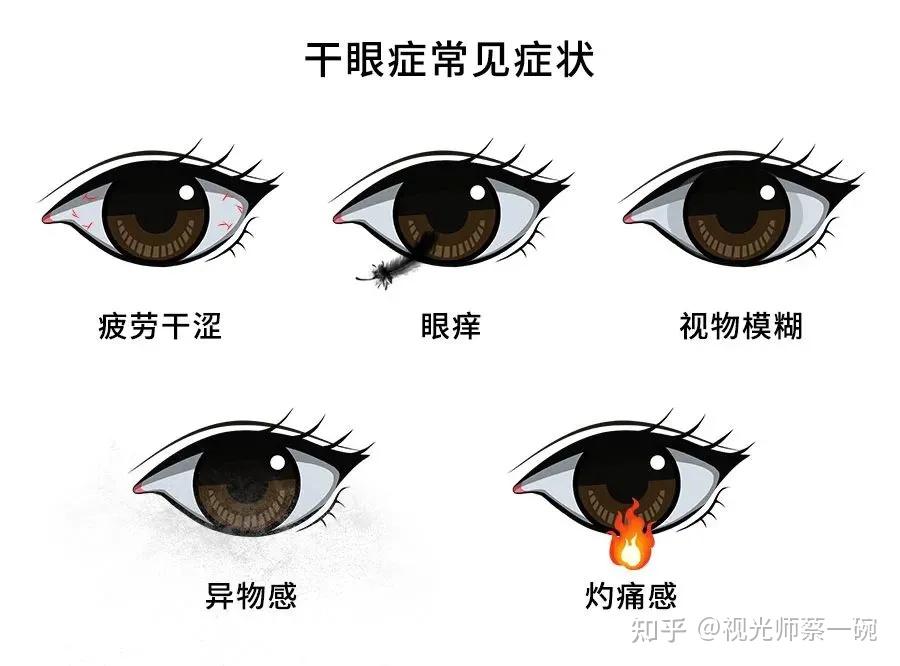 导致泪液缺乏,从而产生眼部干痒不适等症状,常见症状有眼睛痒,干涩,有