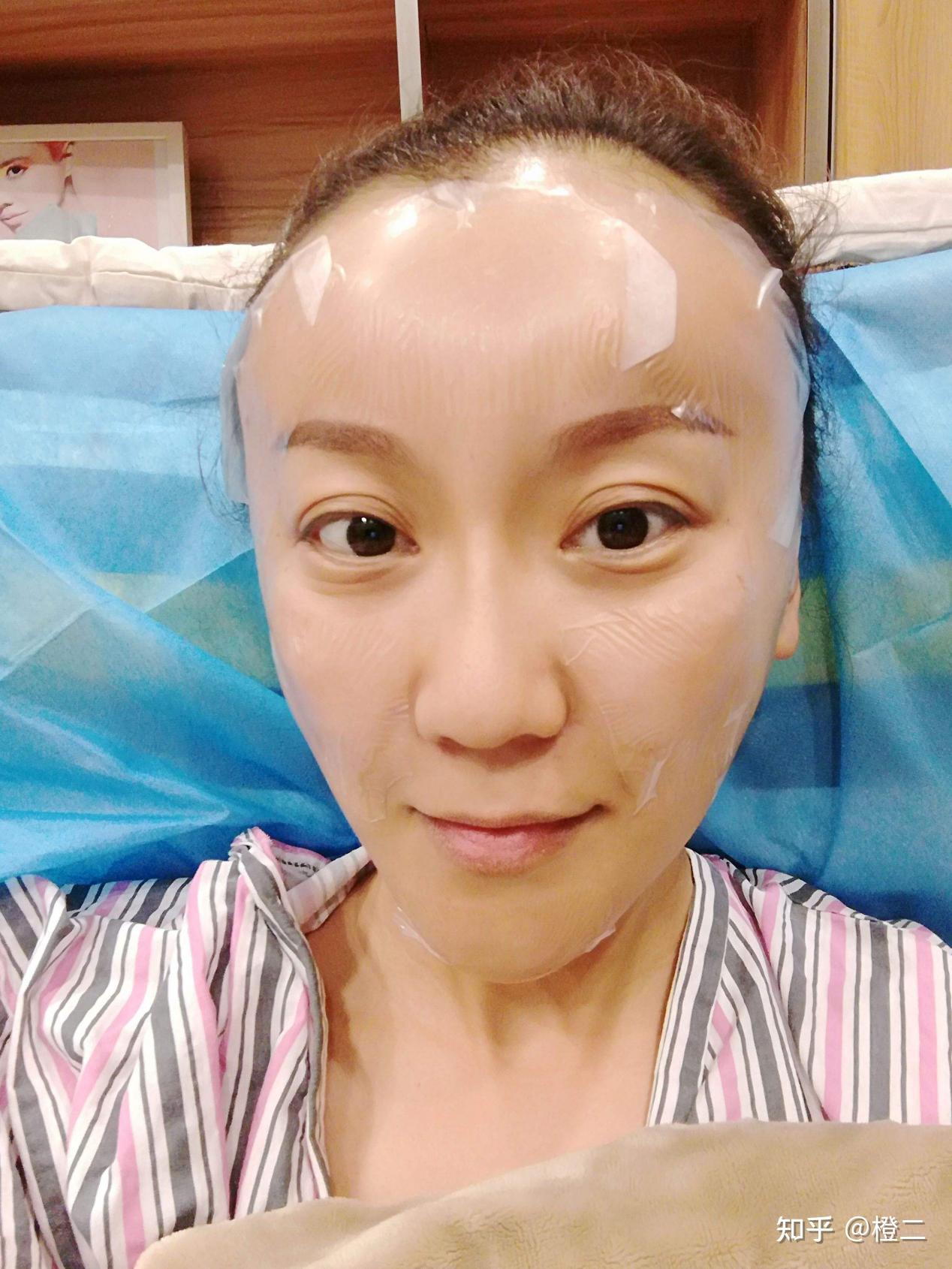 面部凹陷不平，在北京有哪些医生做面部填充靠谱？ - 知乎