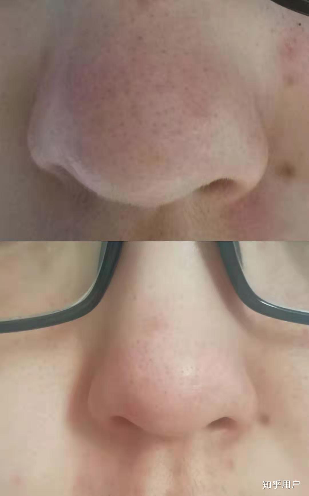 如何在一个月内快速美白皮肤 v2-31d9fad9617f26d6c5f55df173046b1a_r.jpg