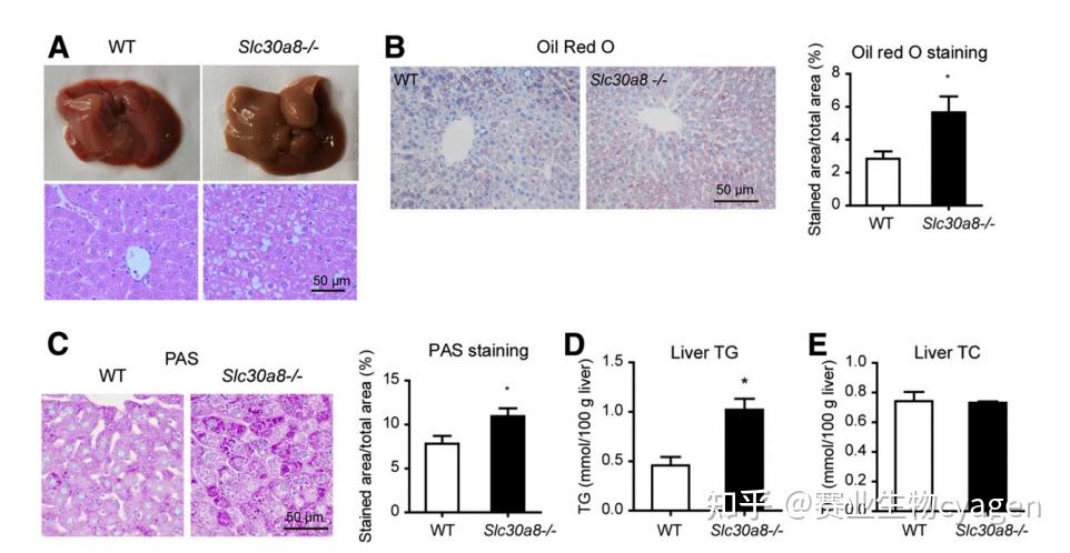肝脏是脂质代谢的一个重要器官,作者通过he染色,油红染色以及pas染色