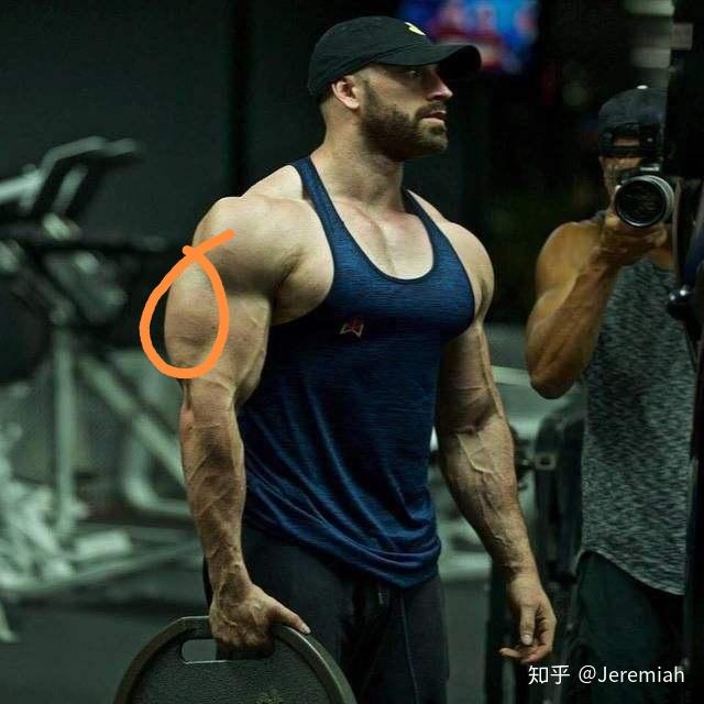 手臂都有哪些肌肉?
