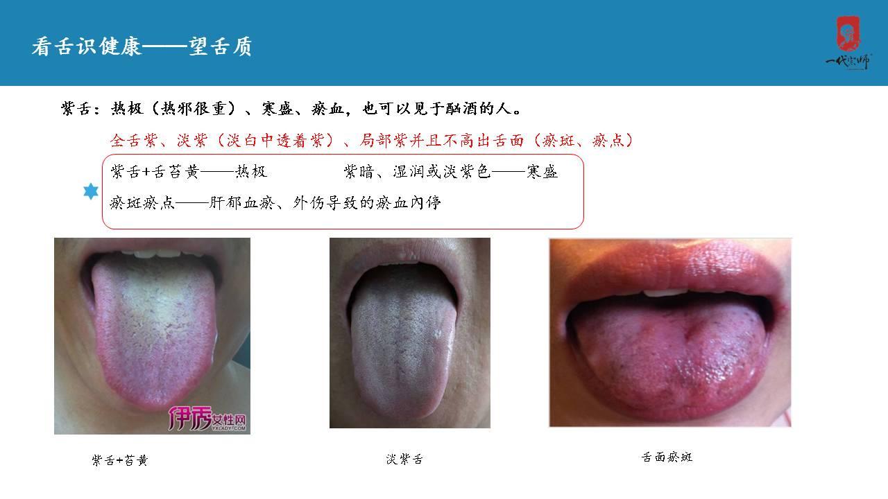 正常的舌苔是怎样的? - 知乎