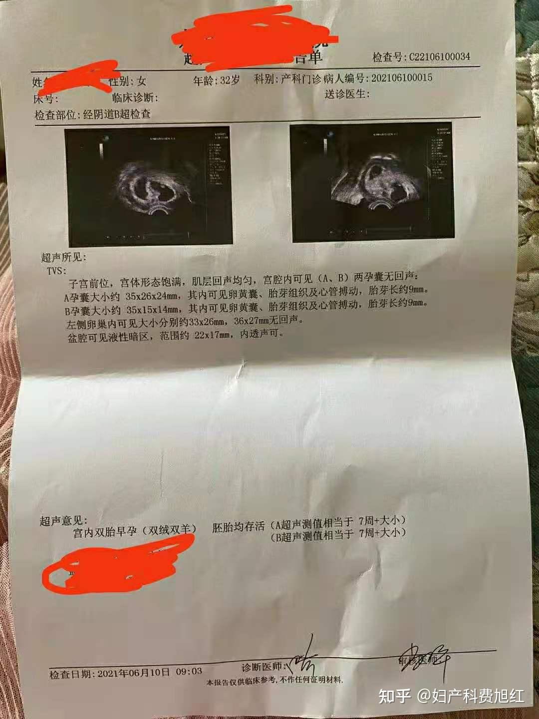 女性幼稚子宫是什么体验?一个幼稚子宫女性的心声