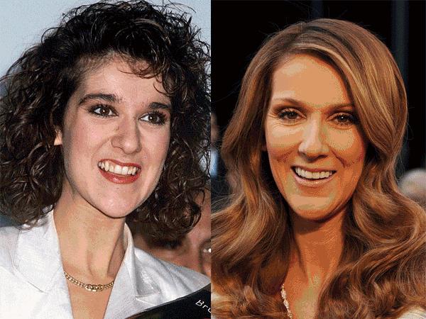 龅牙真的很丑吗