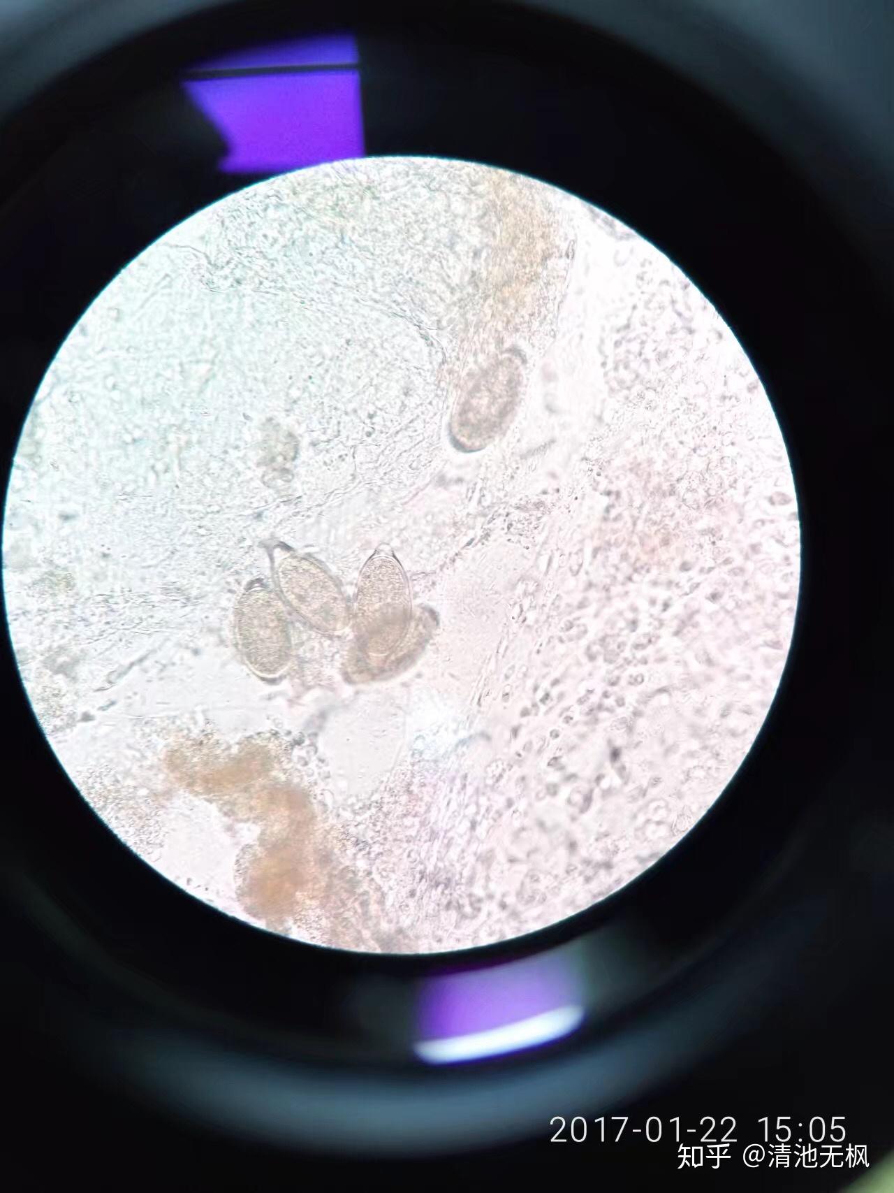 显微镜下的常见虫子