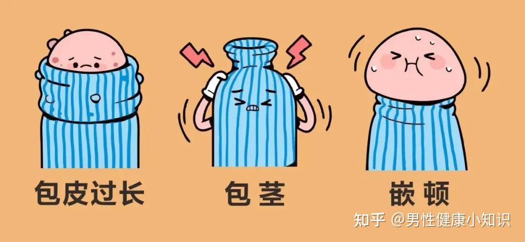 b男士割完包皮,清爽多了,再也不担心女伴炎症感染了!