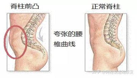 矢状位冠状位示意图图片