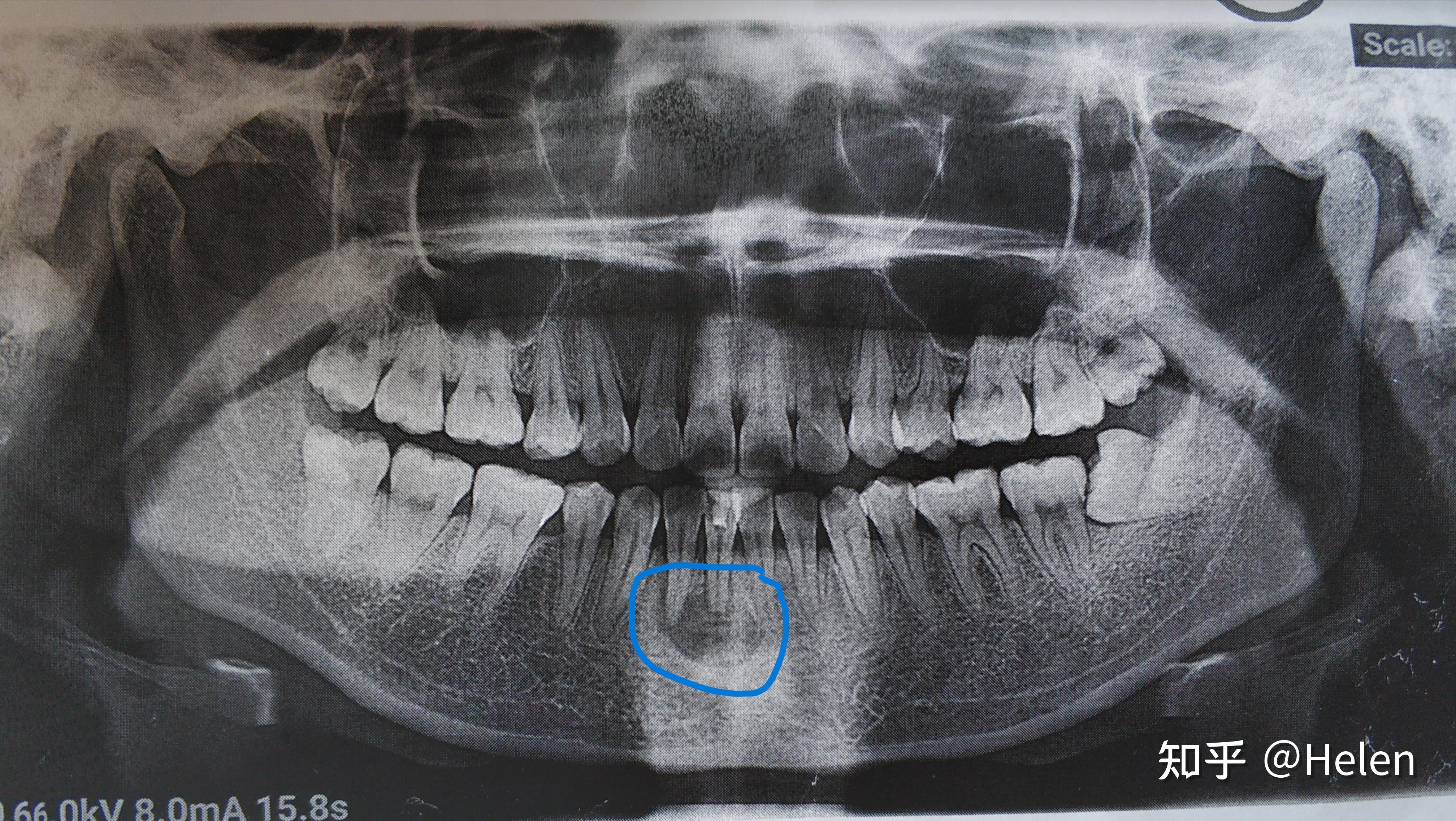 图4-106 下颌运动-口腔颌面及颈部临床解剖学-医学
