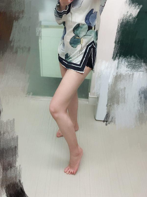 我不仅仅做了吸脂,还做了全脸填充手术呢,因为涉及到隐私就没有发面部