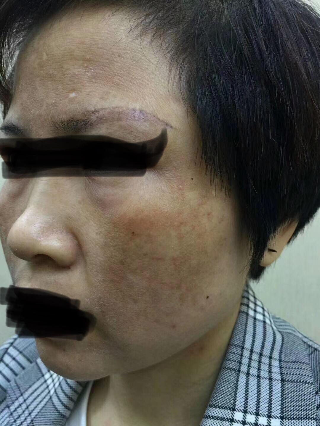 什么是铅汞斑 - 知乎