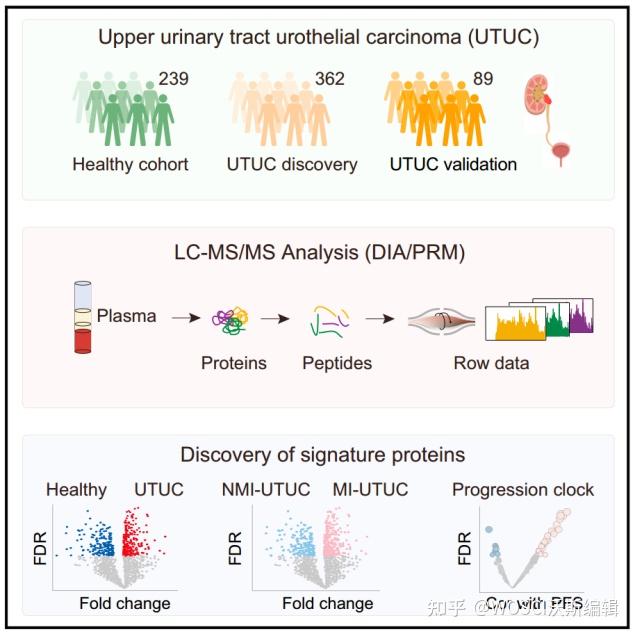Utuc Ribbon Cell子刊 | 复旦大学通过血浆蛋白质组学分析发现与上尿路尿路上皮癌相关的分子特征 - 知乎