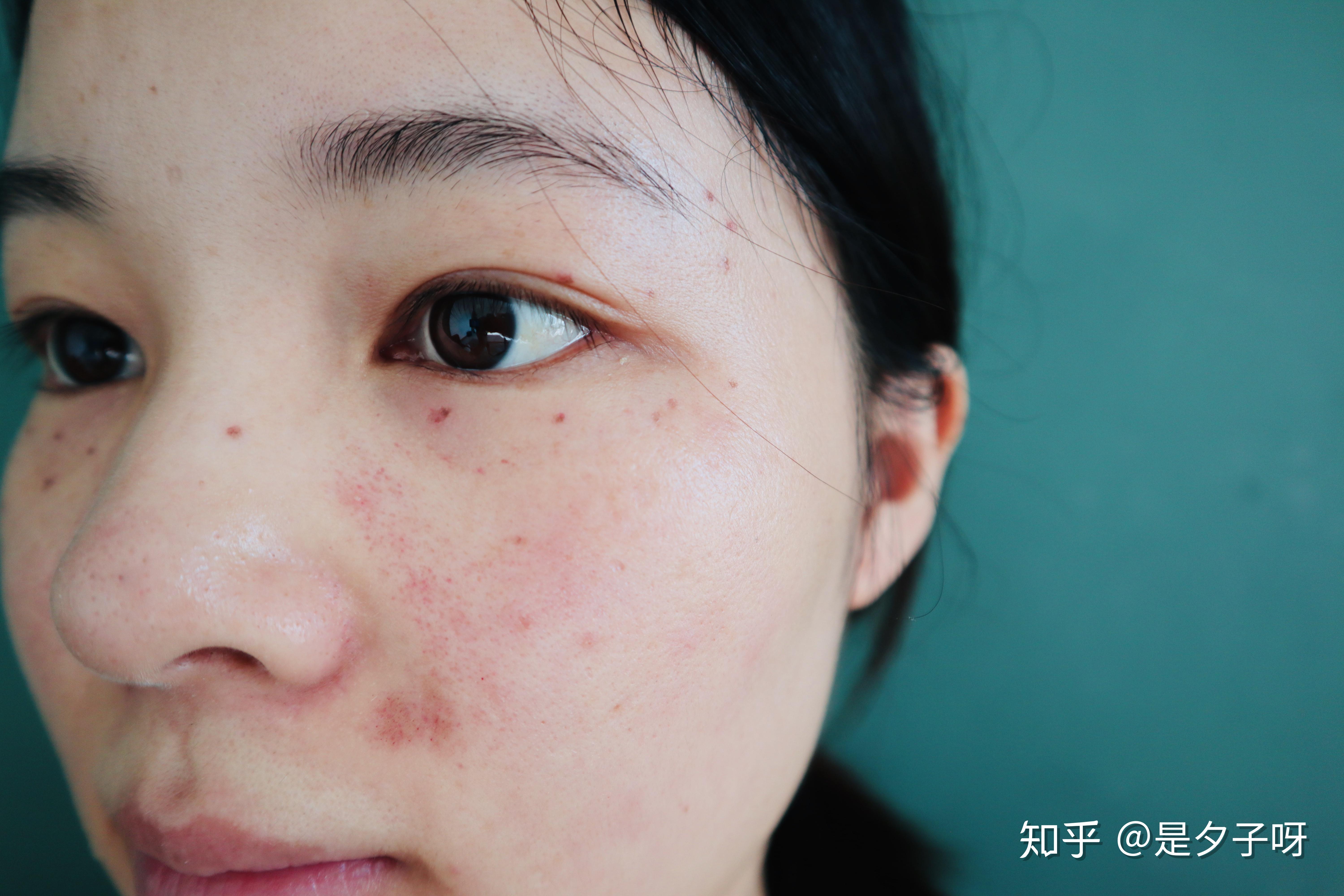 做超皮秒是个什么样的体验为什么有几百和几万的差别