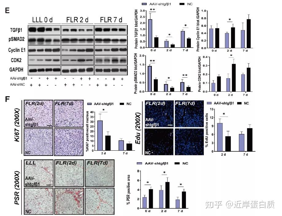 相关的肝再生之间的关系,我们设计了 hsc 特异性 aav-gfap-shtgfβ1