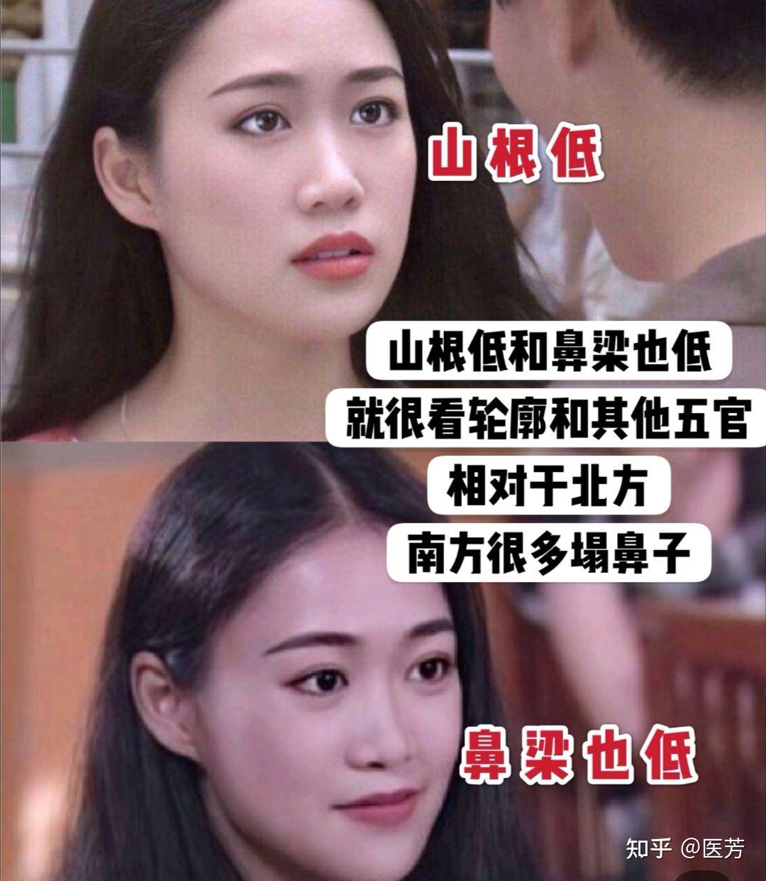 你的鼻子属于山根低还是鼻梁低