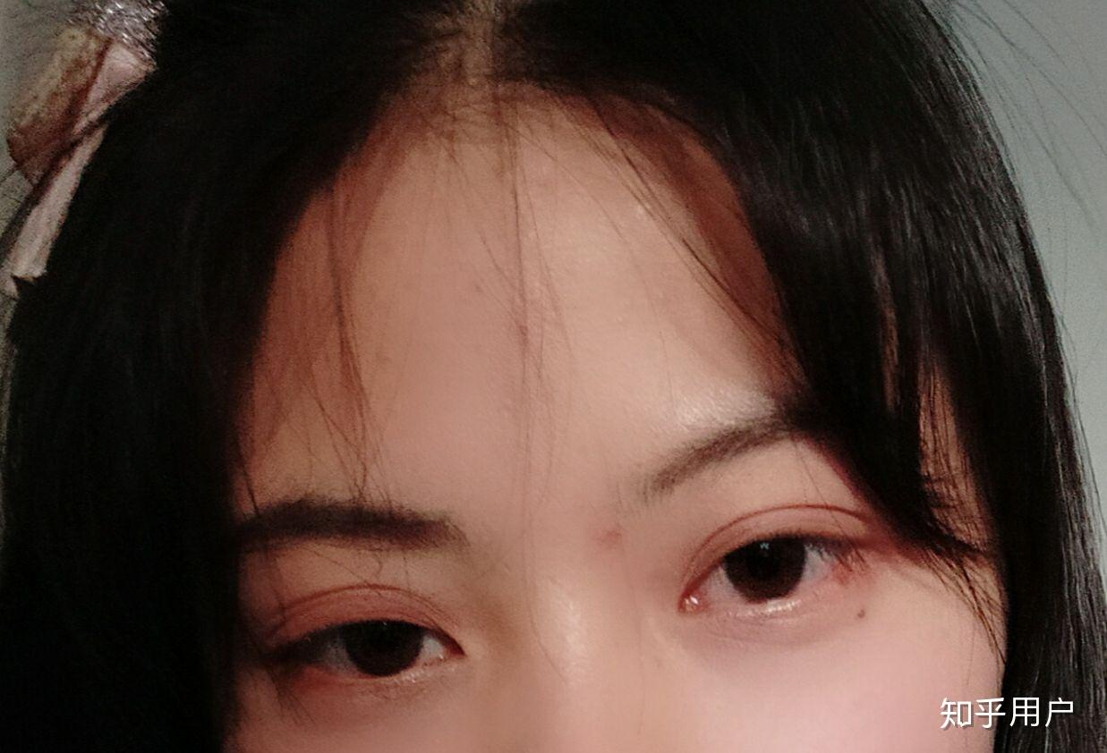 得了抑郁症的人眼神是不是都是一样的?