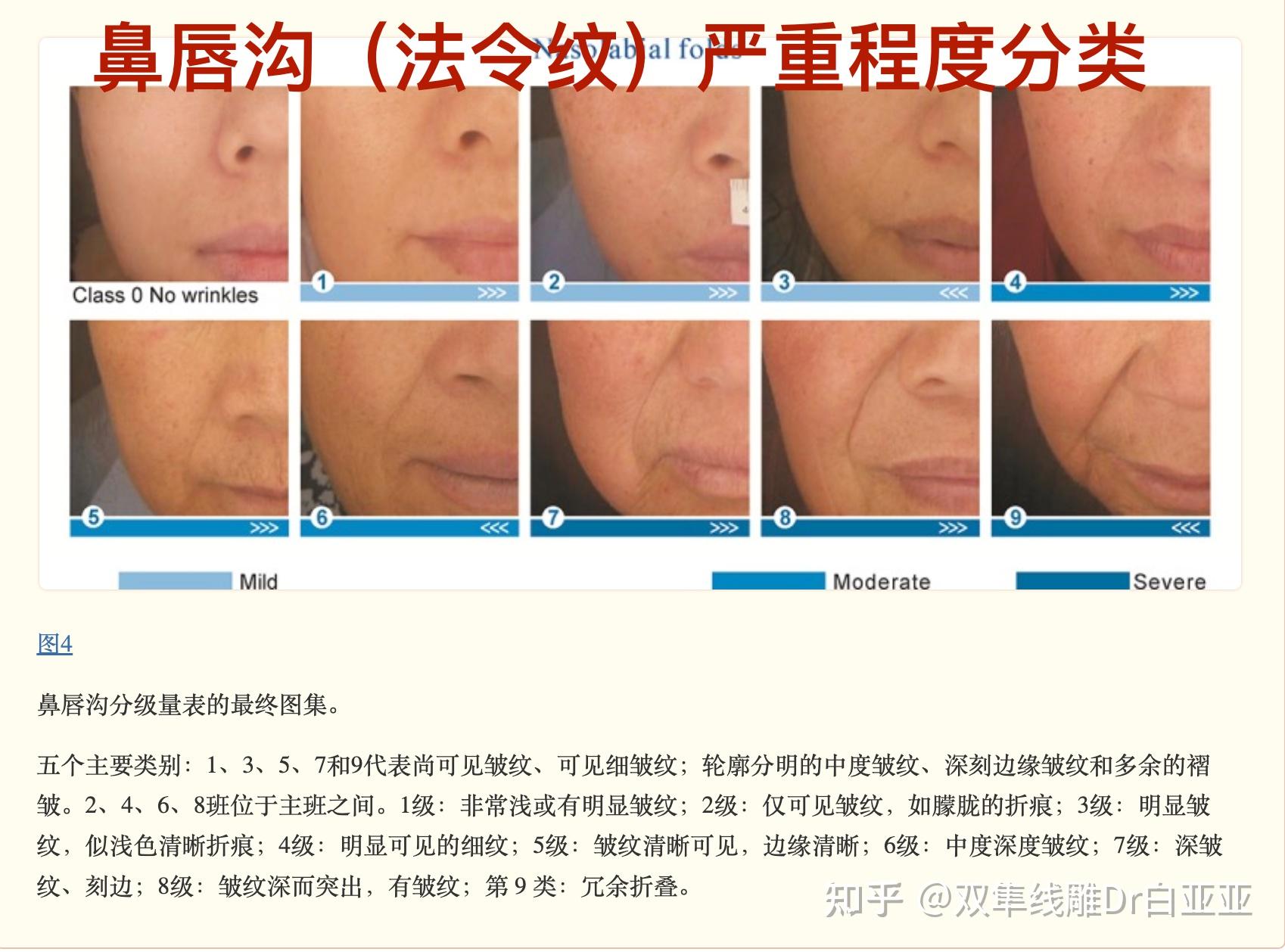 皱纹的分类以及严重程度等级划分 - 知乎