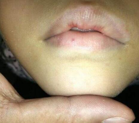 婴儿嘴唇颜色正常图图片