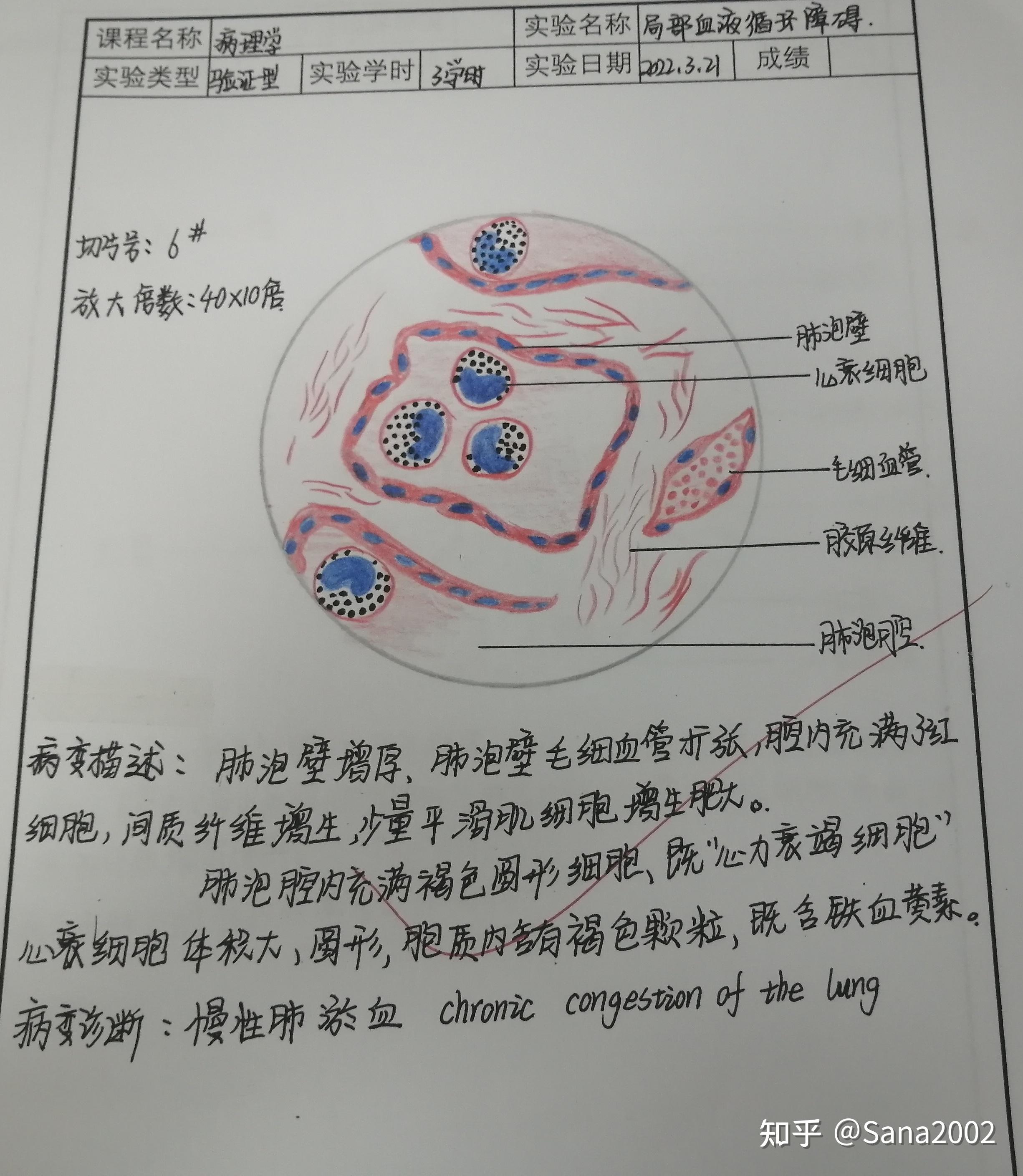 病理學實驗紅藍鉛筆圖醫學生