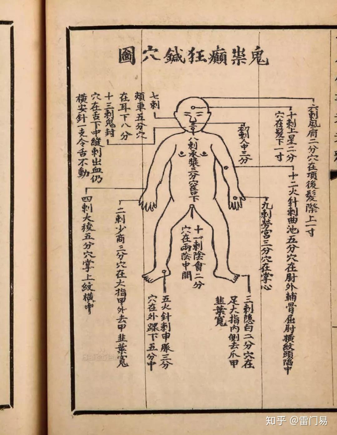 "驱鬼还阳"的十三鬼针!