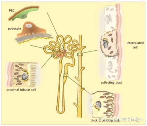 dent病1型由clcn5基因突变导致的