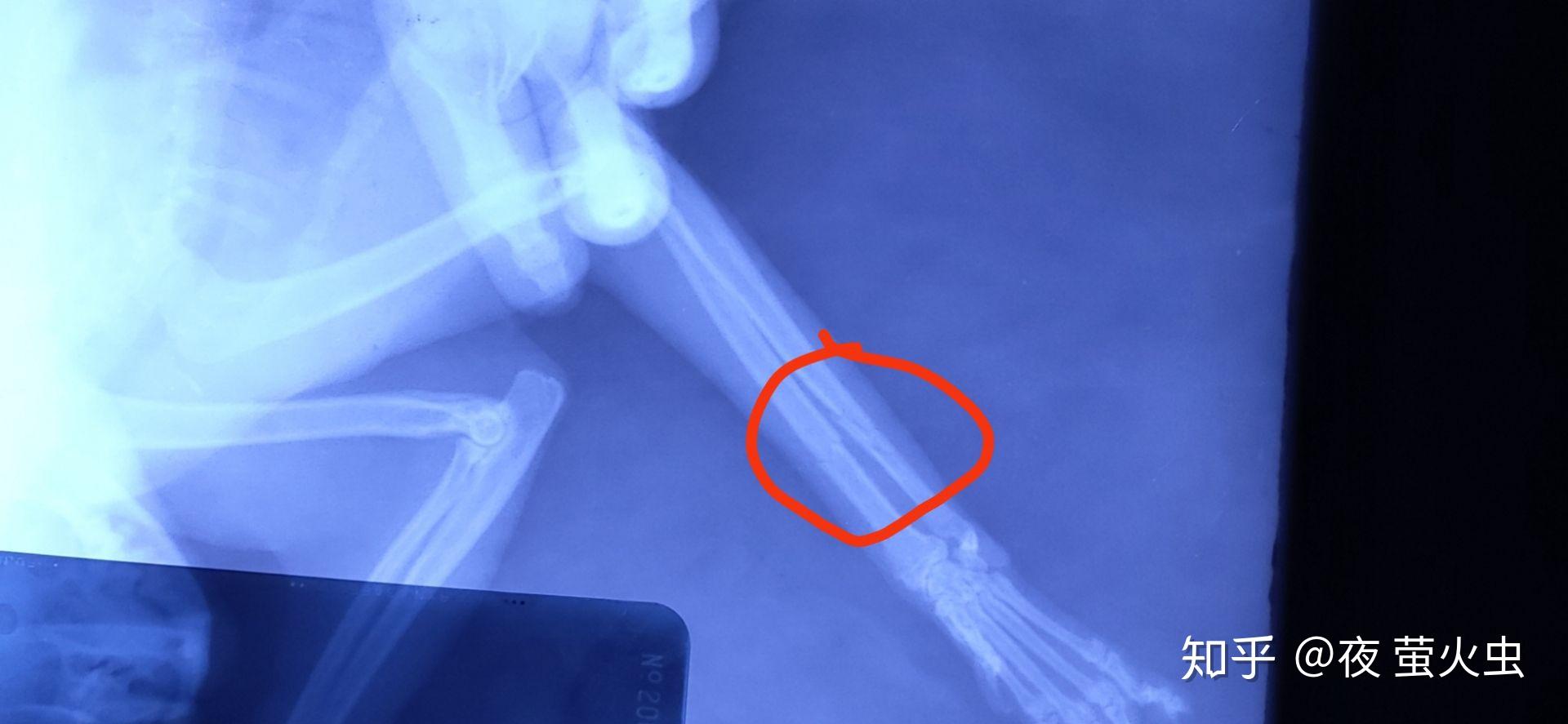 猫尺桡骨骨折可以自愈么