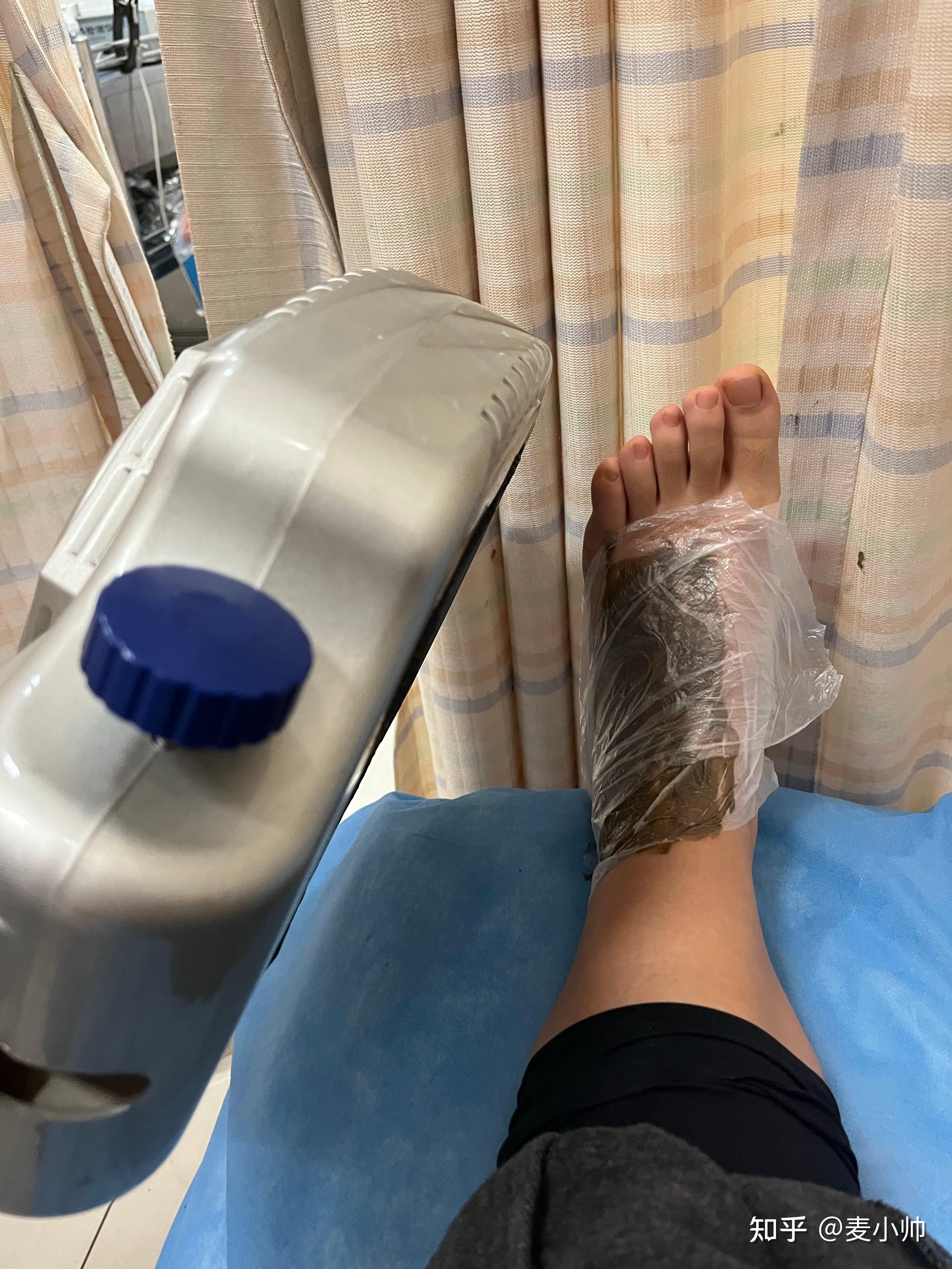 崴了一次脚get到好多知识&认知,一次性说清!