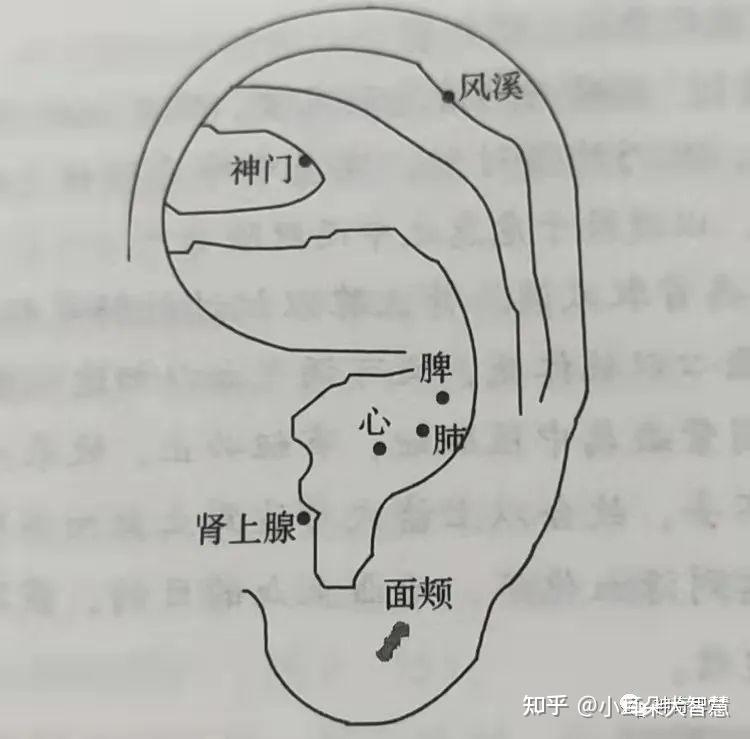 治疗 取耳穴 神门