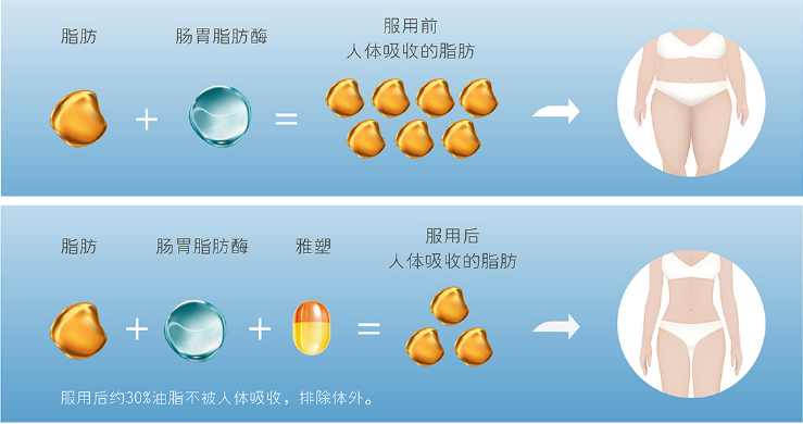 奧利司他主要是通過抑制胃酸,胃腸道的脂肪酶,阻止三酰甘油水解為遊離