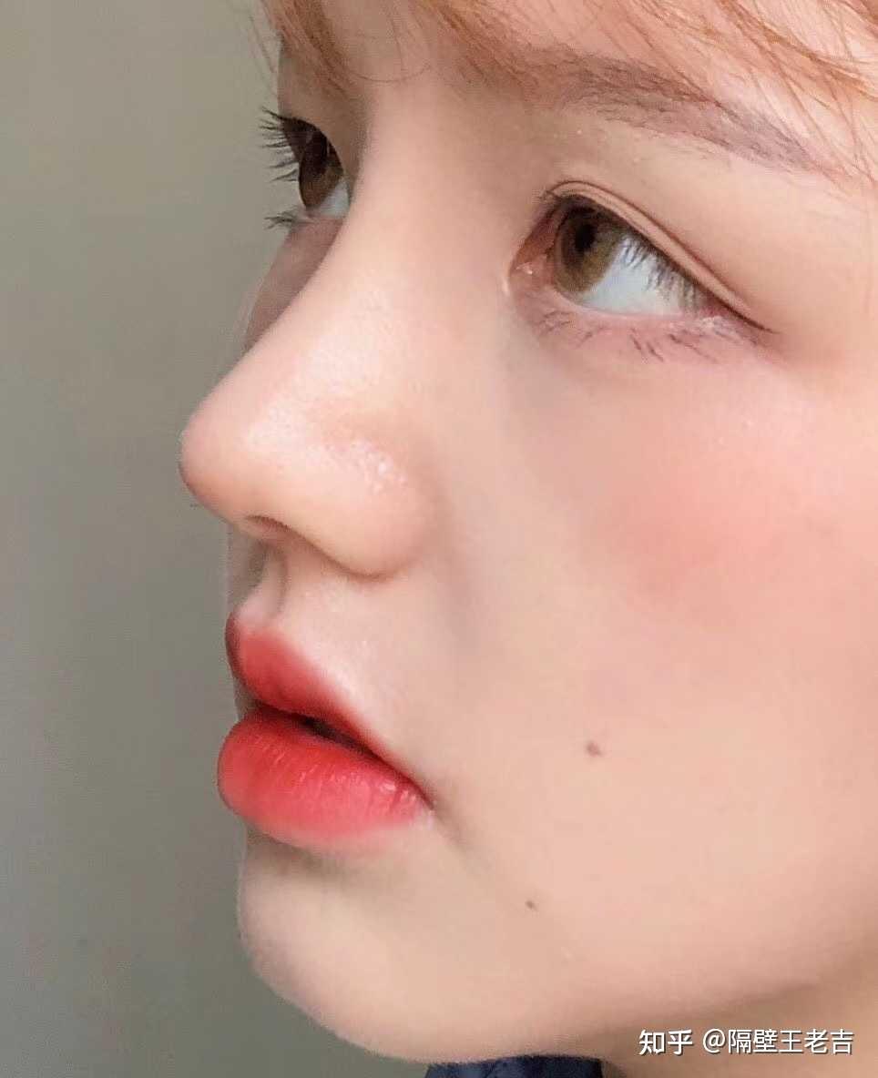 广州隆鼻有做得好的医生吗广州隆鼻风格解析