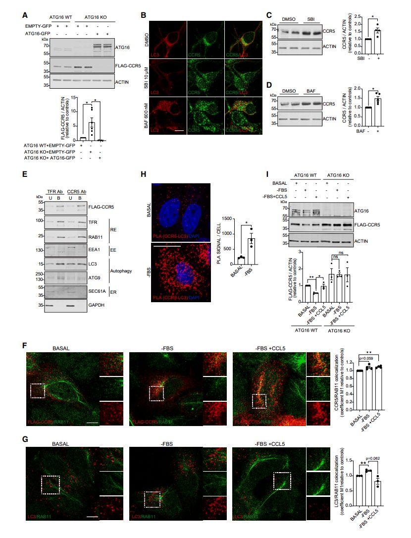 活化小胶质细胞以非细胞自主方式抑制神经元自噬参与神经退行病变