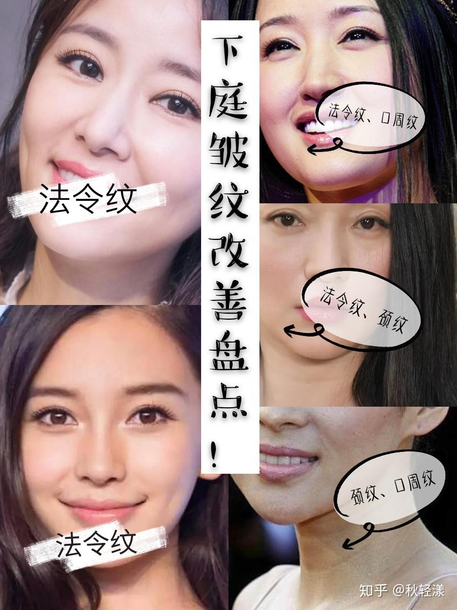 告别衰老!法令纹,口周纹,颈纹去除秘籍! - 知乎